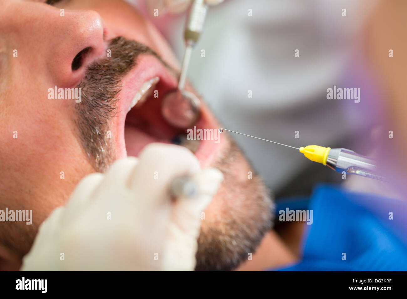 Männliche Patienten mit Zahnarzt und Assistenz in einer zahnärztlichen Behandlung tragen Masken und Handschuhe, Anesthetization Spritze geben Stockfoto