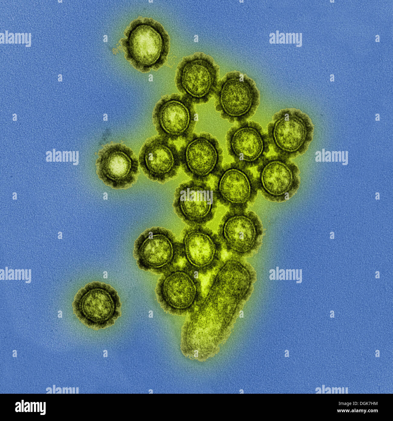 Elektronenmikroskopische Aufnahme von H1N1 Influenza A Stockfoto