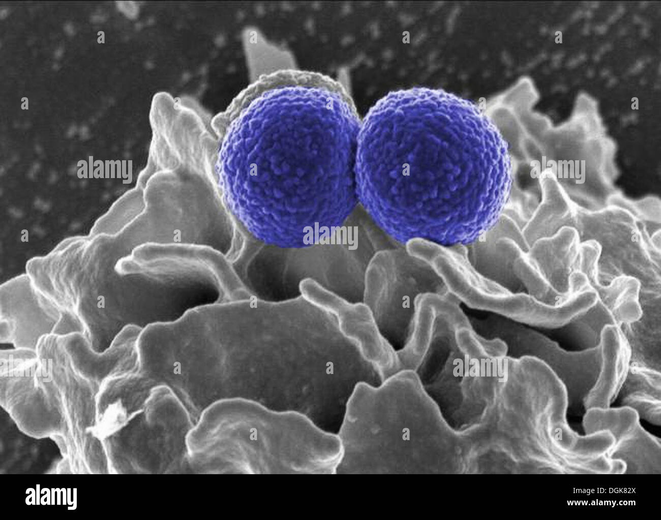 MRSA, Staphylococcus Aureus-Bakterien Stockfoto