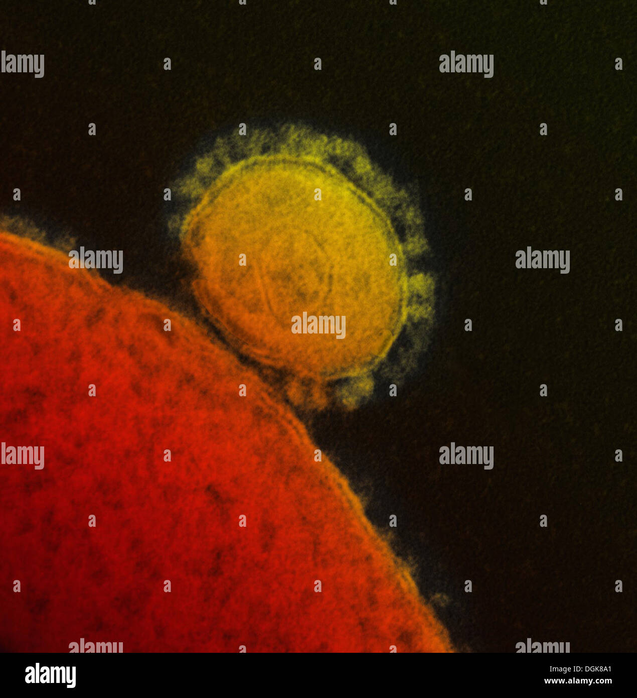 Nahen Osten respiratorisches Syndrom coronavirus Stockfoto