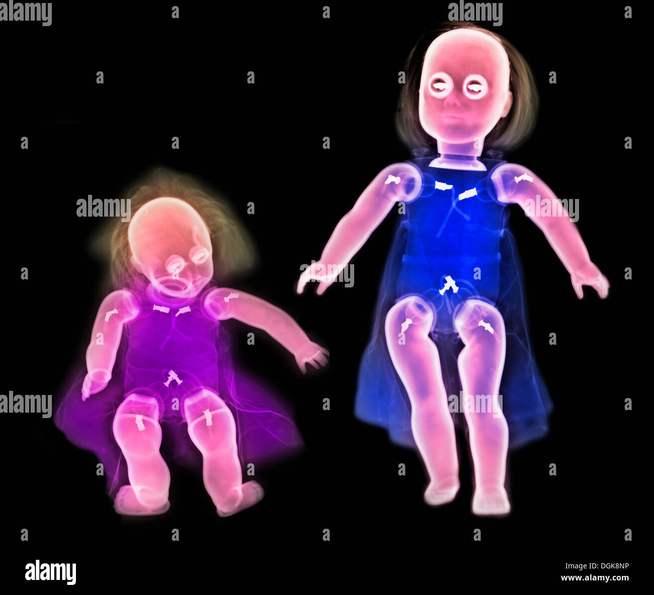 Eingefärbte Röntgen von zwei Puppen Stockfoto