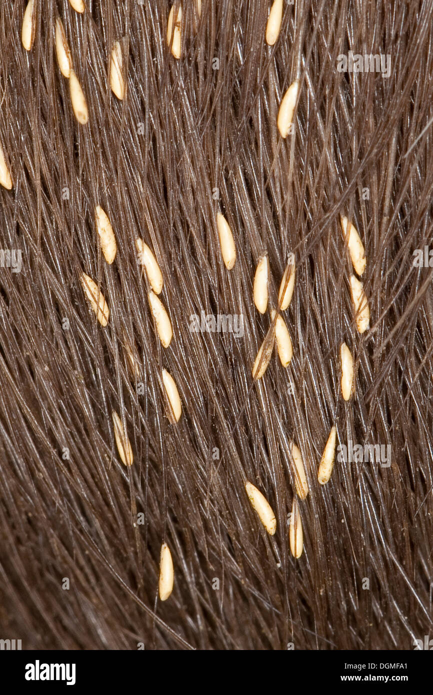 Pferd, Botflies, Pferd Darkness, Eiern, Magendassel, Magendasselfliege