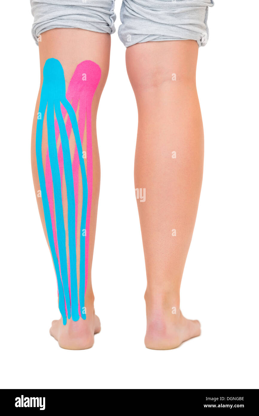 Weibliche Patienten Bein mit angewandter rosa und blauen Kinesio tape