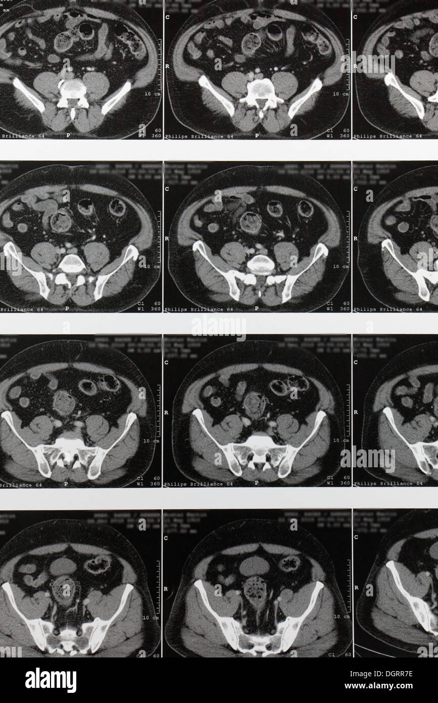 Mehrschicht berechnet, Computertomographie, Magnetresonanztomographie, MRT-Untersuchung der inneren Organe Stockfoto