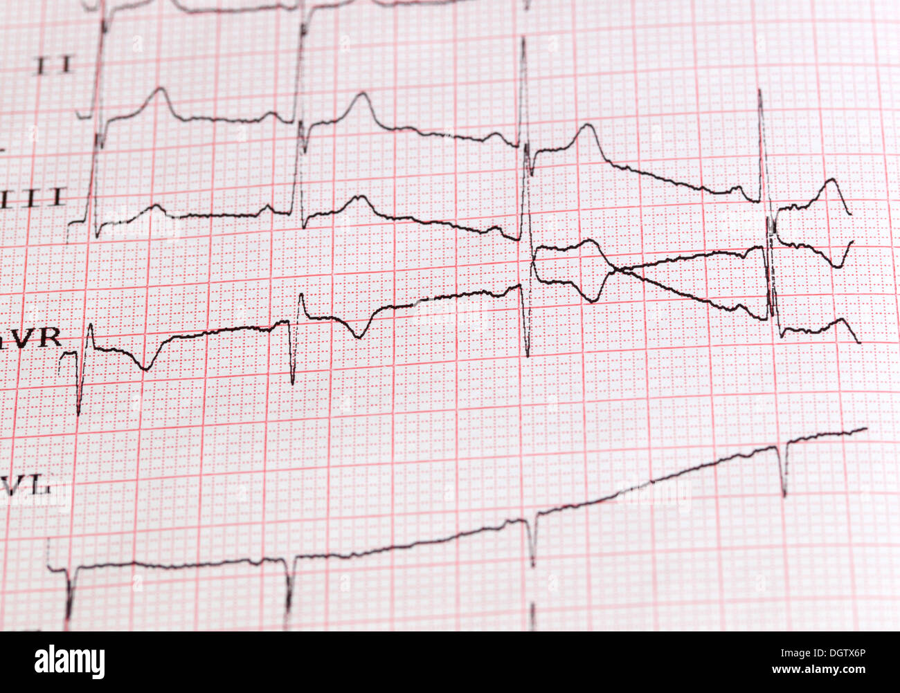 Die Foto-EKG auf Papier Stockfoto