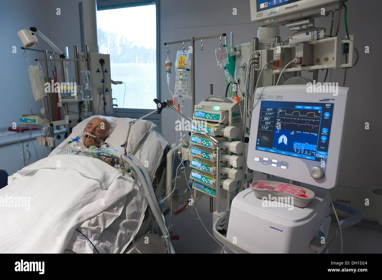 Intensive Pflege eines älteren Patienten auf einer Leben-Unterstützung-Maschine nach umfangreichen Großbetrieb durchziehen Stockfoto