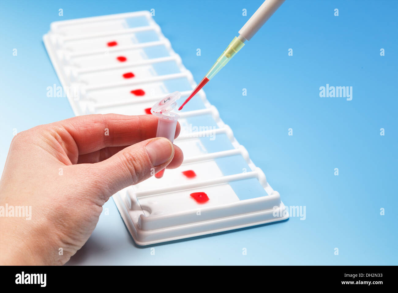 Blutprobe auf einen Objektträger Stockfoto