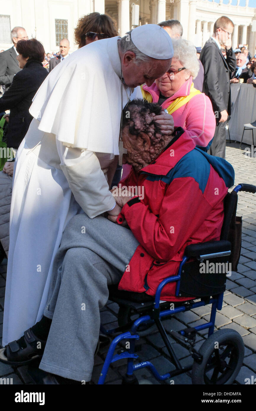 Vatikan, Rom, Italien. 6. November 2013. Vatikan Papst Francis, Generalaudienz 6. November 2013 Papst Francis umarmen und segnen eine Person krank der Neurofibromatose während der Generalaudienz vom 6. November in St. Peter Quadrat © wirklich Easy Star/Alamy Live News Stockfoto