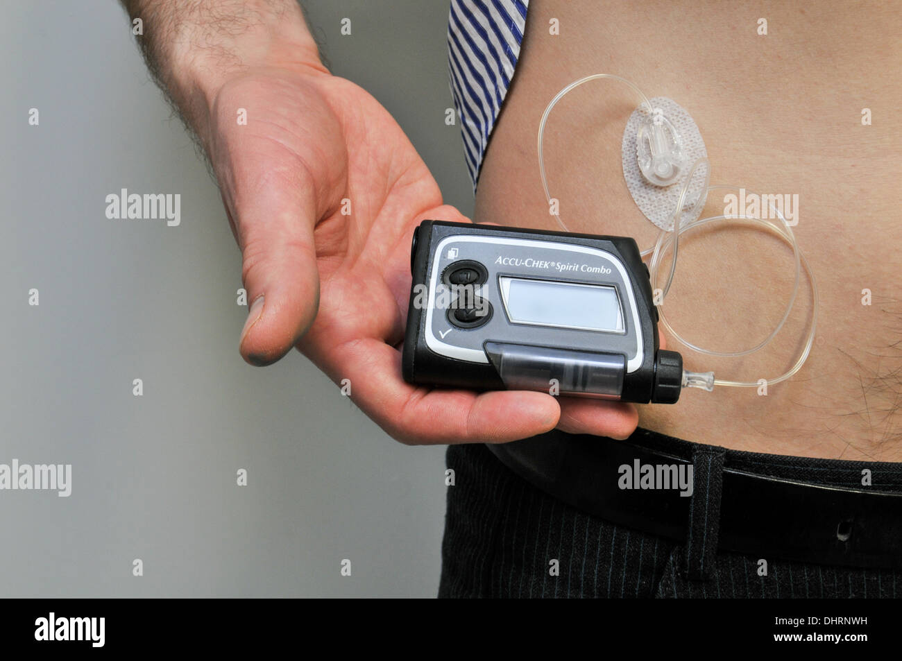 Ein AccuChek Spirit Combo für das Pumpen von Insulin in eines Diabetikers Stockfoto, Bild