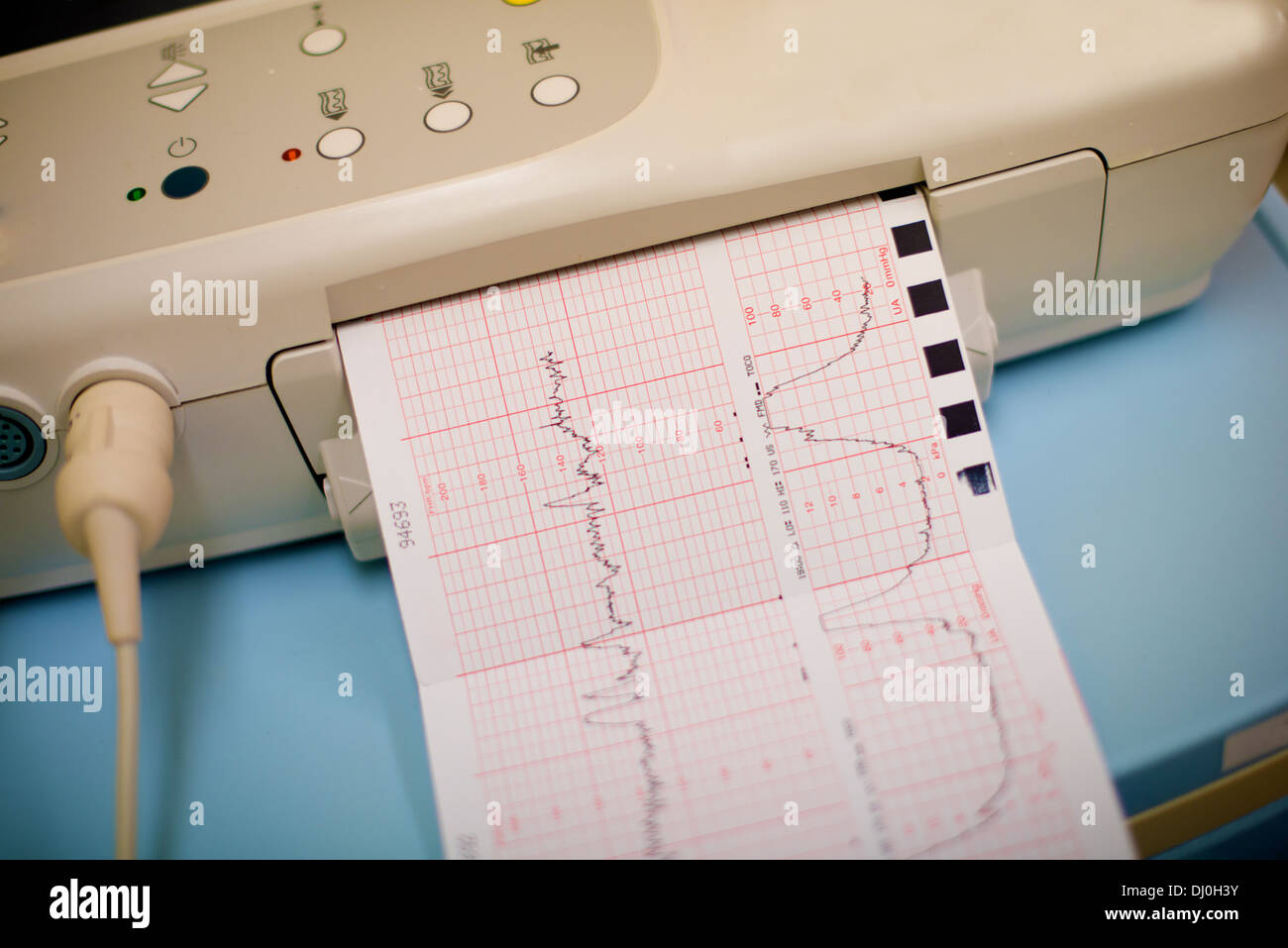 Wehen, die Überwachung im Krankenhaus Stockfoto