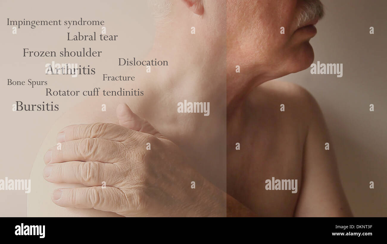 Mann mit Hand auf Schulter mit Worten von Gelenkerkrankungen Stockfoto