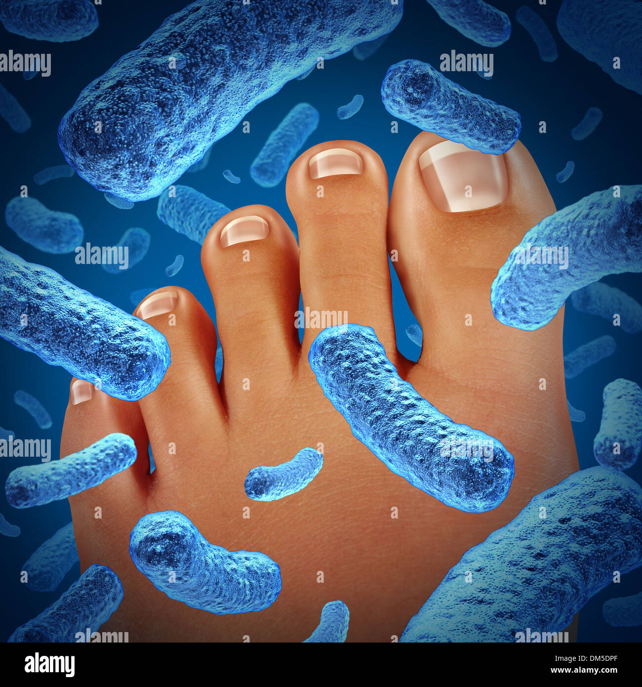Fuß Bakterien krankmachenden einen stinkenden Geruch mit einer engen des menschlichen Körpers zeigt Zehen mit blauen bakterielle Infektion-Gefahr Stockfoto