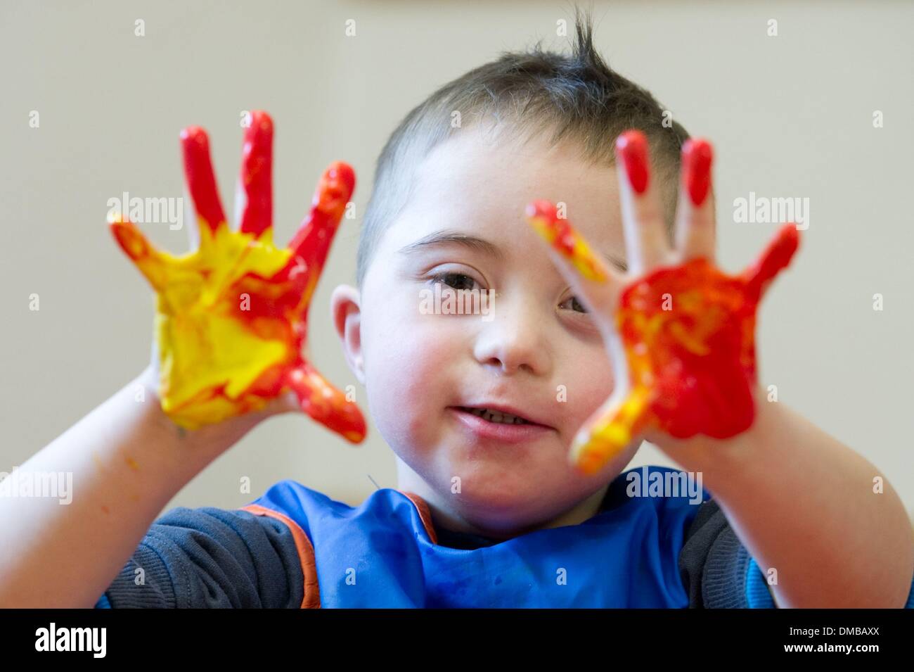 Dresden, Deutschland. 5. Dezember 2013. Fünf-jährige Valentino mit Down Syndrom sitzt während der Ergotherapie in einem Therapieraum im Sociopediatric-Zentrum (SPZ) am Klinikum Dresden-Neustadt in Dresden, Deutschland, 5. Dezember 2013. (Model-Release verfügbar) Foto: Sebastian Kahnert/Dpa/Alamy Live News Stockfoto