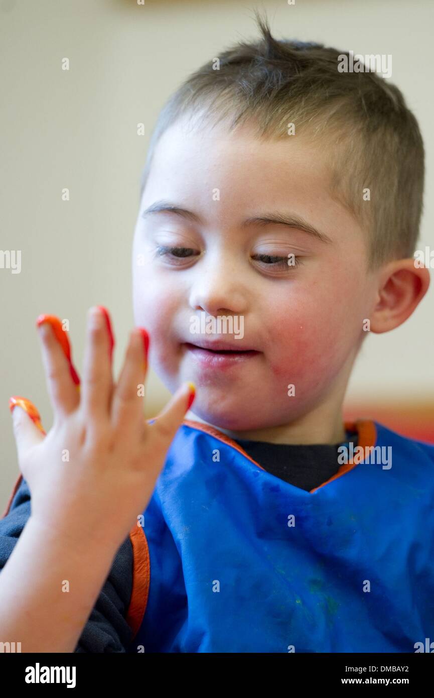 Dresden, Deutschland. 5. Dezember 2013. Fünf-jährige Valentino mit Down Syndrom sitzt während der Ergotherapie in einem Therapieraum im Sociopediatric-Zentrum (SPZ) am Klinikum Dresden-Neustadt in Dresden, Deutschland, 5. Dezember 2013. (Model-Release verfügbar) Foto: Sebastian Kahnert/Dpa/Alamy Live News Stockfoto