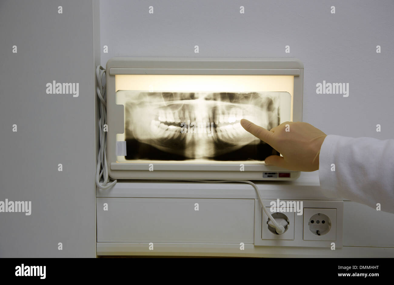 Hand zeigt im Röntgenbild der Kiefer in einer Zahnarztpraxis Stockfoto