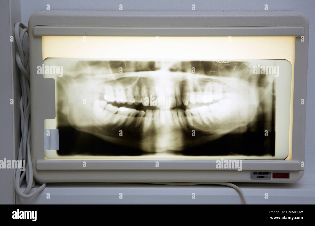 Röntgenaufnahme des Kieferknochens in einer Zahnarztpraxis Stockfoto