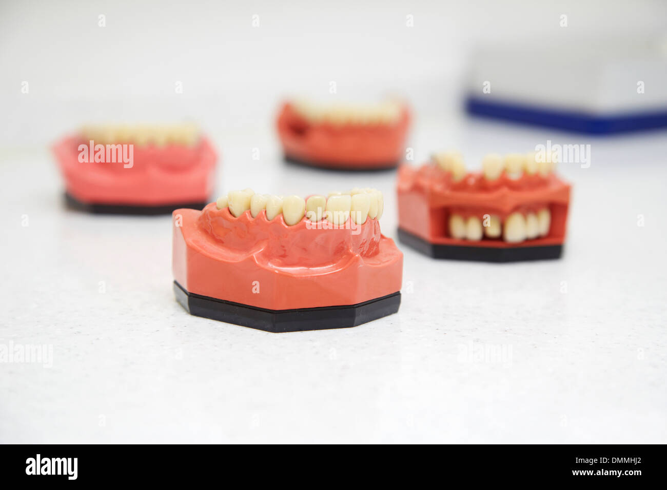 Zahnersatz in einer Zahnarztpraxis Stockfoto