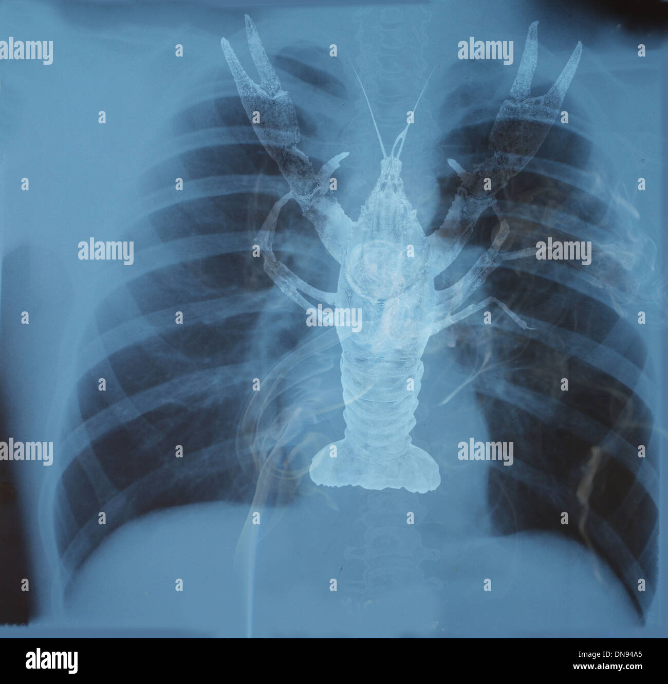 Krebse auf Hintergrund der Lunge Stockfoto