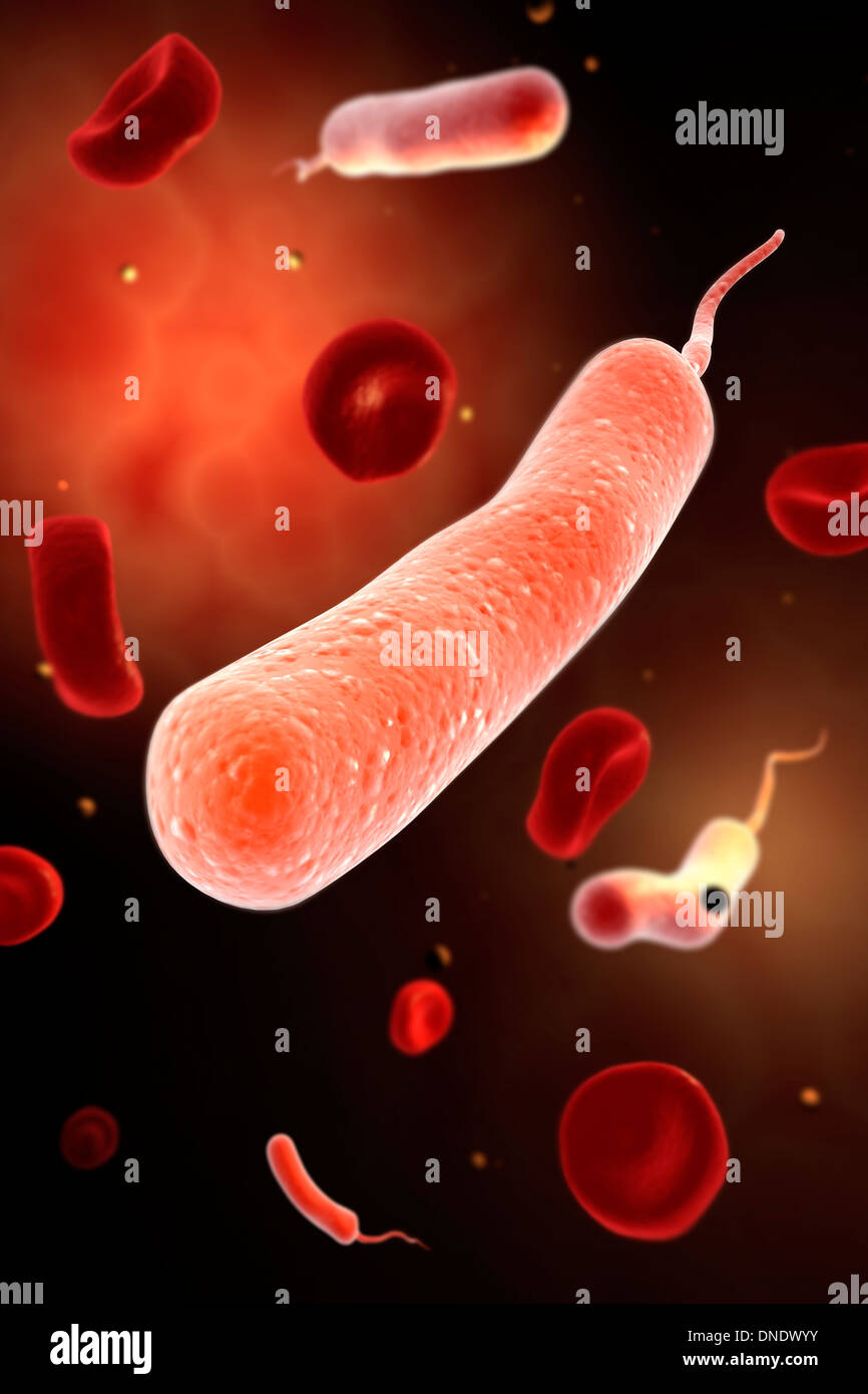 Konzeptbild von Vibrio Cholerae verursacht Cholera. Stockfoto