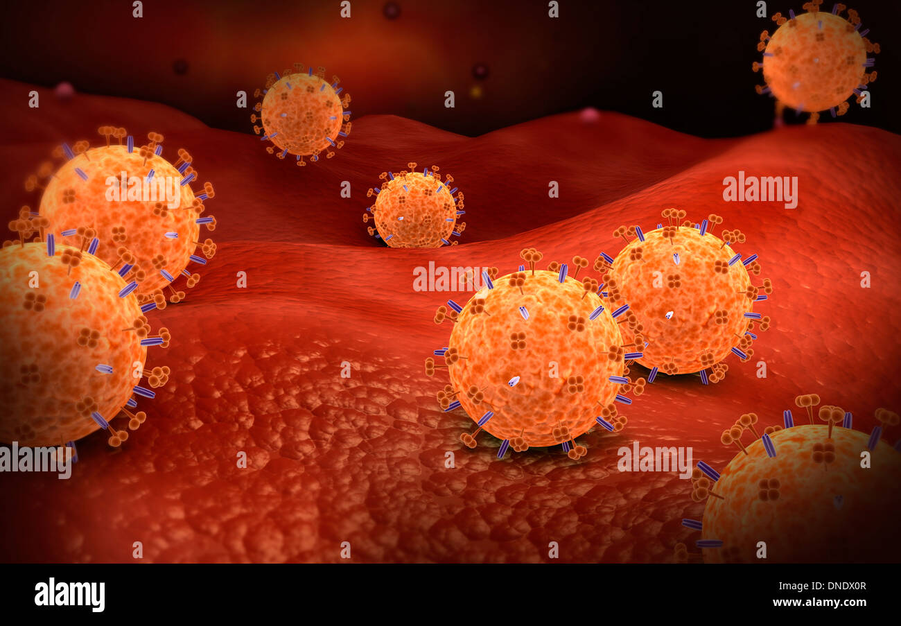 Konzeptbild von Influenza Grippe verursacht. Stockfoto