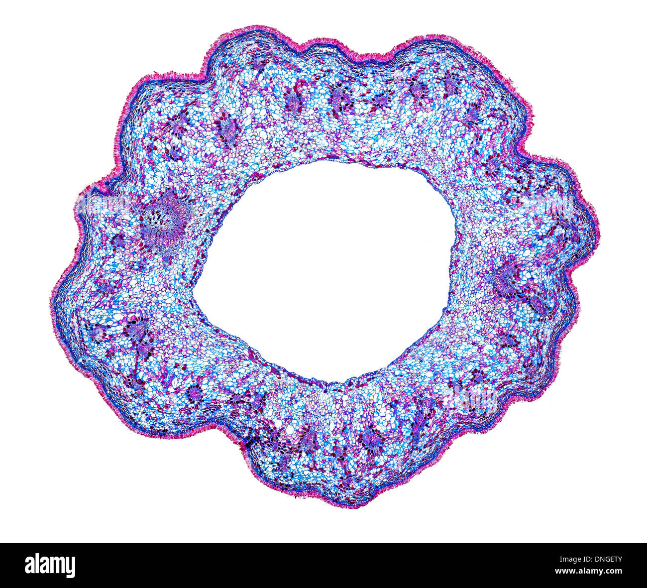 Hellfeld Mikrophotographie einer Schlehe Frucht mit Taphrina Pruni TS infiziert. Stockfoto