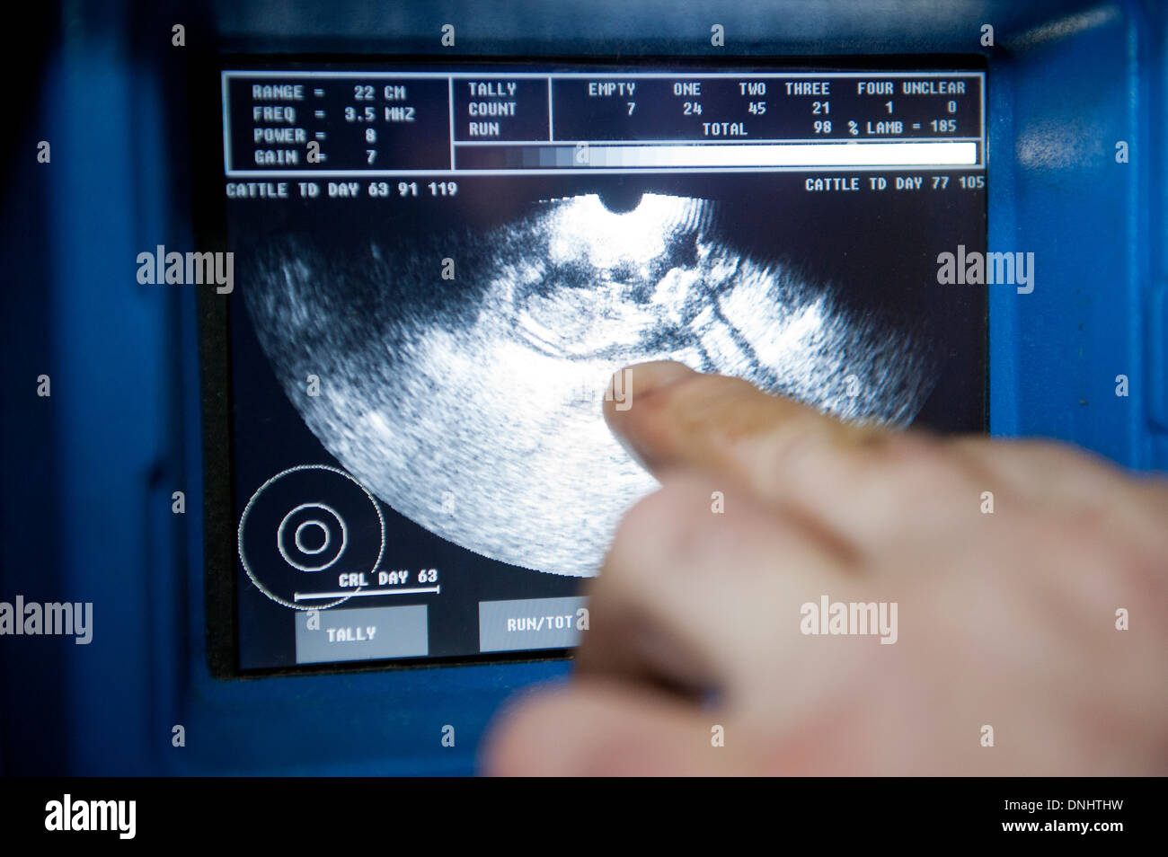 Ultraschall-Scanneroperator Lamm in eine schwangere Aue hingewiesen. VEREINIGTES KÖNIGREICH. Stockfoto