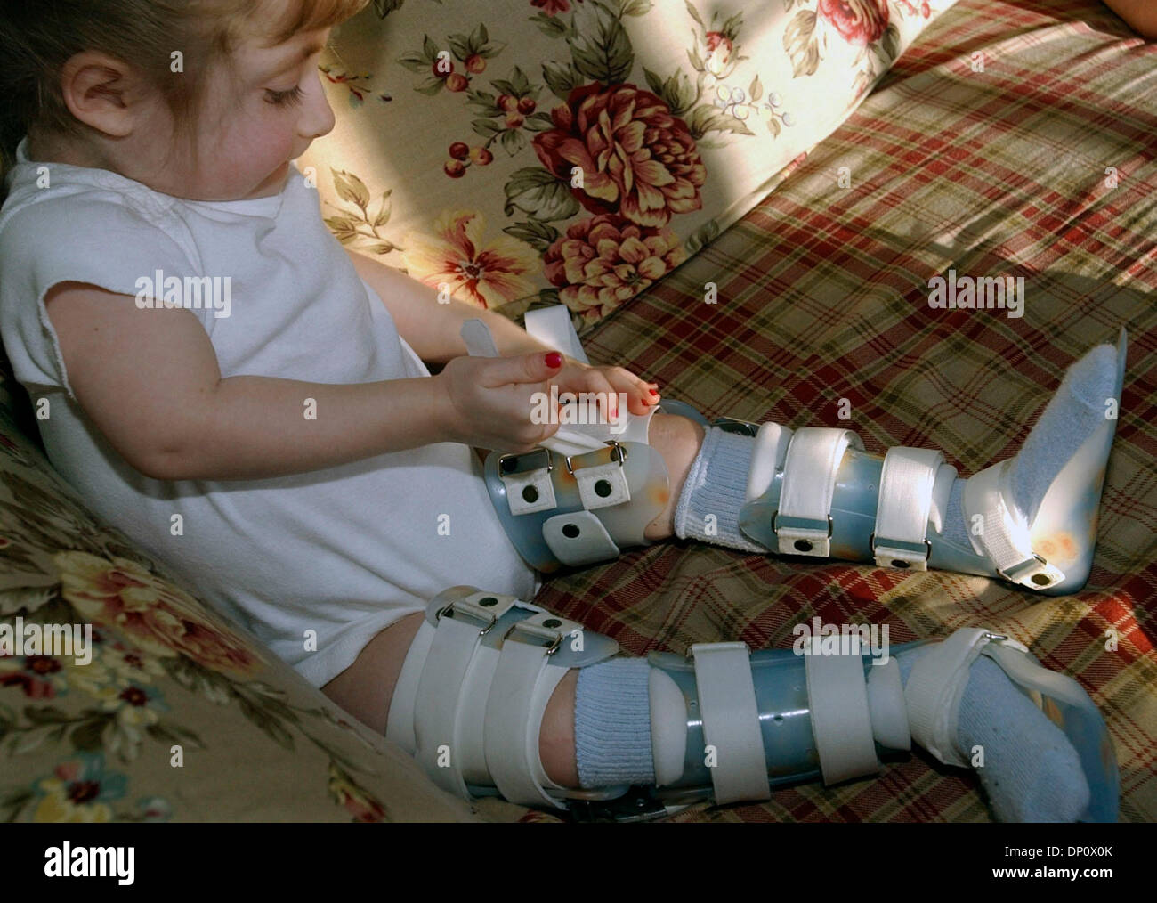 6. April 2006; International Falls, MN, USA; Five-Year-Old Hoffnung Moss setzt auf ihre Beinschienen zur Vorbereitung der Besuch des Kindergartens. Five-Year-Old Hoffnung Moss Glasknochenkrankheit leidet, aber ist der Besuch des Kindergartens in International Falls trotz der Gefahr von Knochenbrüchen.  Obligatorische Credit: Foto von Joey McLeister/Minneapolis Star T/ZUMA Press. (©) Copyright 2006 von Minneapo Stockfoto