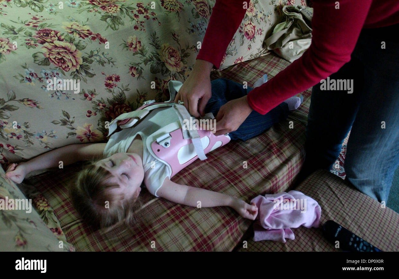 6. April 2006; International Falls, MN, USA; Five-Year-Old Hoffnung Moss hat ihre Orthese von Körperpflege Assistenten Danni Kallerman aufsetzen, wie sie bereit für den Kindergarten in Grundschule fällt.  Moss hat Glasknochenkrankheit. Five-Year-Old Hoffnung Moss Glasknochenkrankheit leidet, aber ist der Besuch des Kindergartens in International Falls trotz der Gefahr von Knochenbrüchen. Obligatorische C Stockfoto