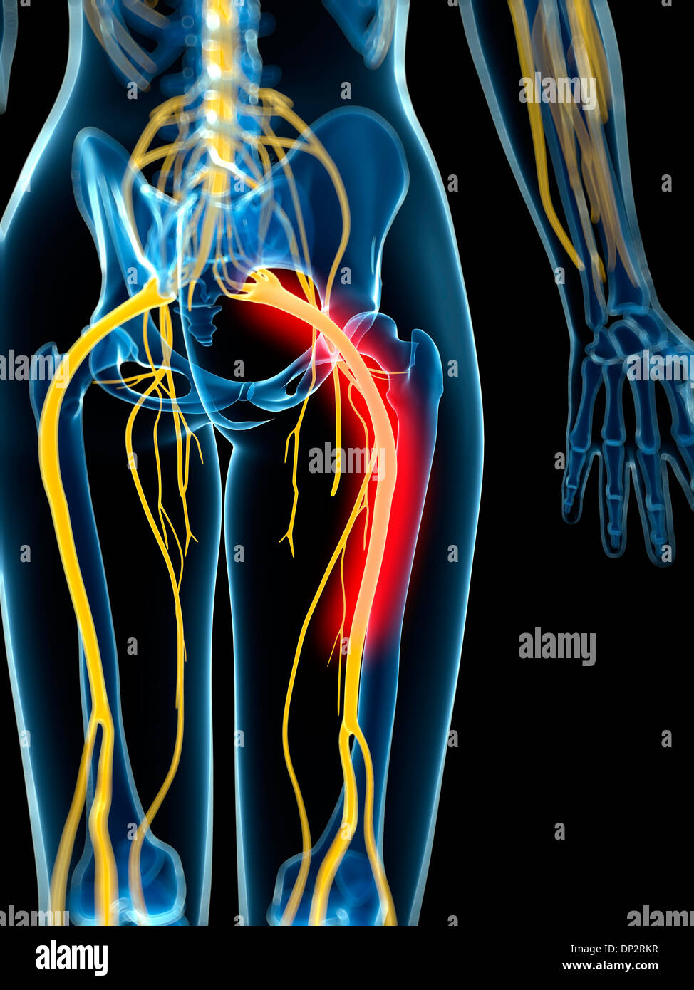 Schmerzhafte Ischiasnerv, artwork Stockfoto