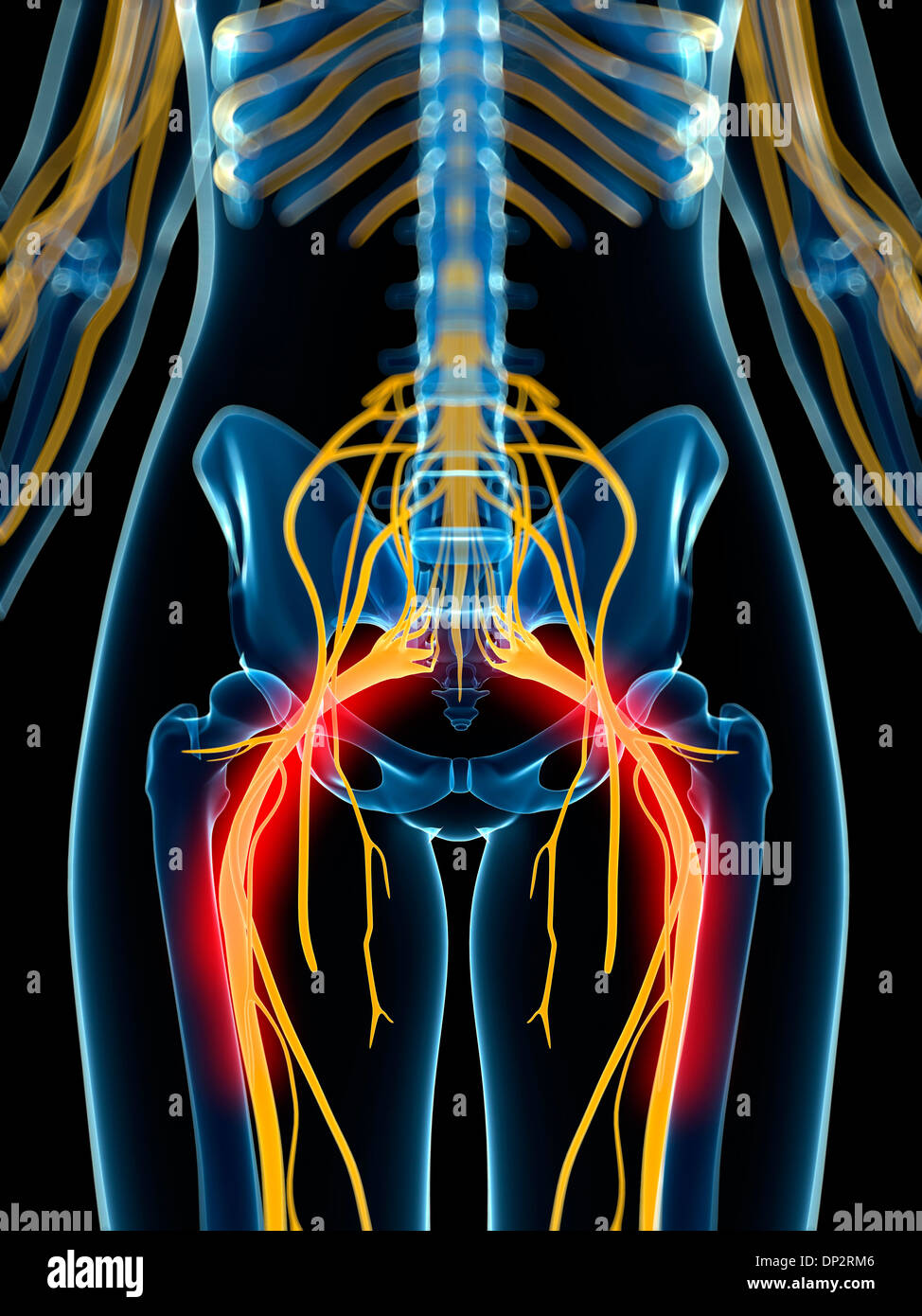 Schmerzhafte Ischiasnerv Kunstwerk Stockfoto
