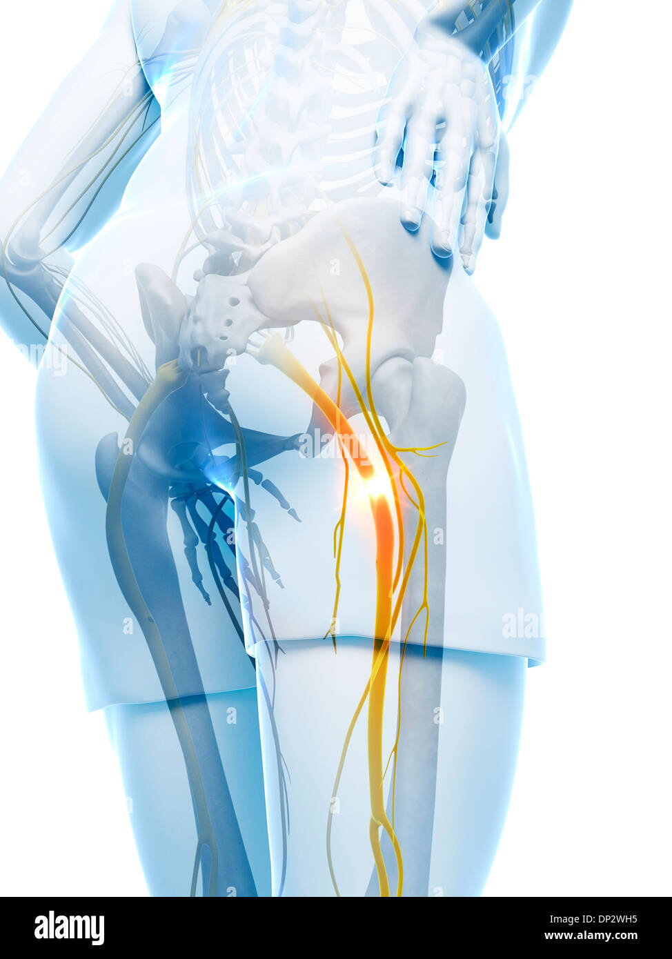 Schmerzhafte Ischiasnerv, artwork Stockfoto