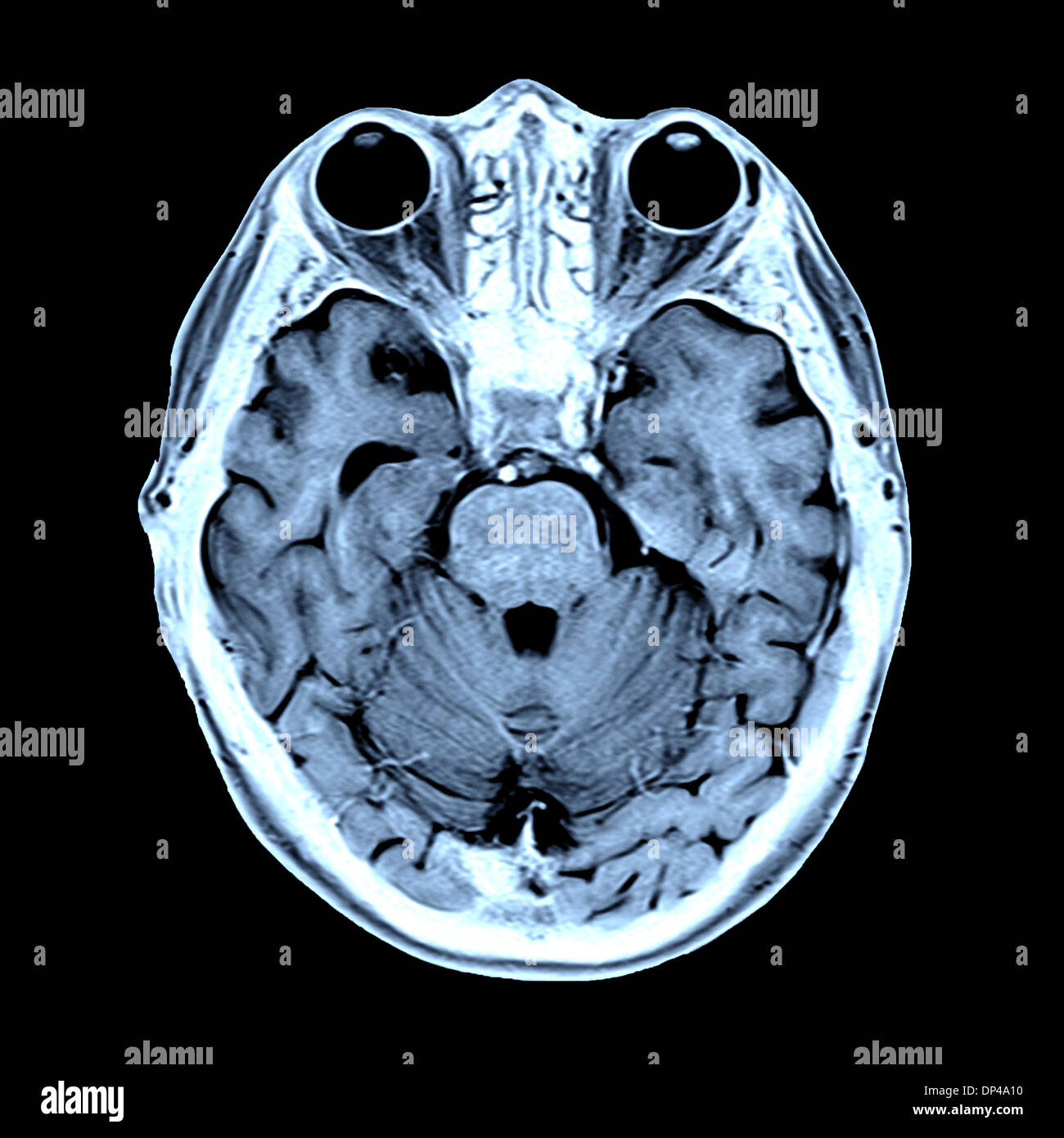 Farbige MRT-Untersuchung des menschlichen Kopfes Stockfoto