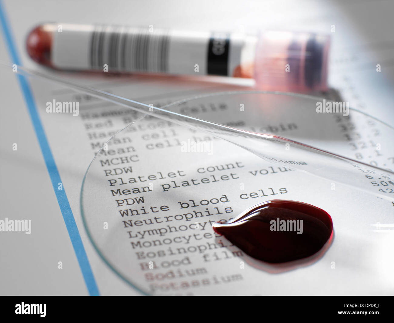 Blutprobe mit Ergebnissen der klinischen Analyse der Blutkomponente Stockfoto