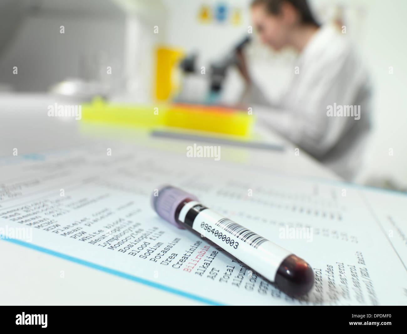 Blut-Rohr sitzt auf Blutwerte mit Techniker am Mikroskop im Labor Stockfoto