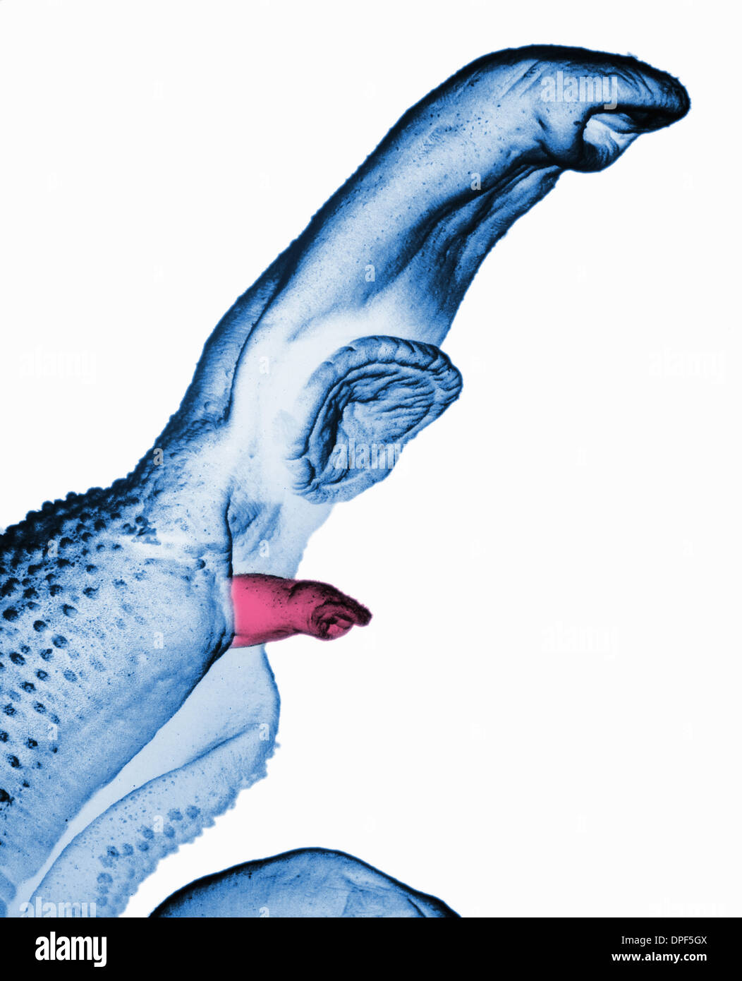SEM der Schistosoma Wurm Stockfoto