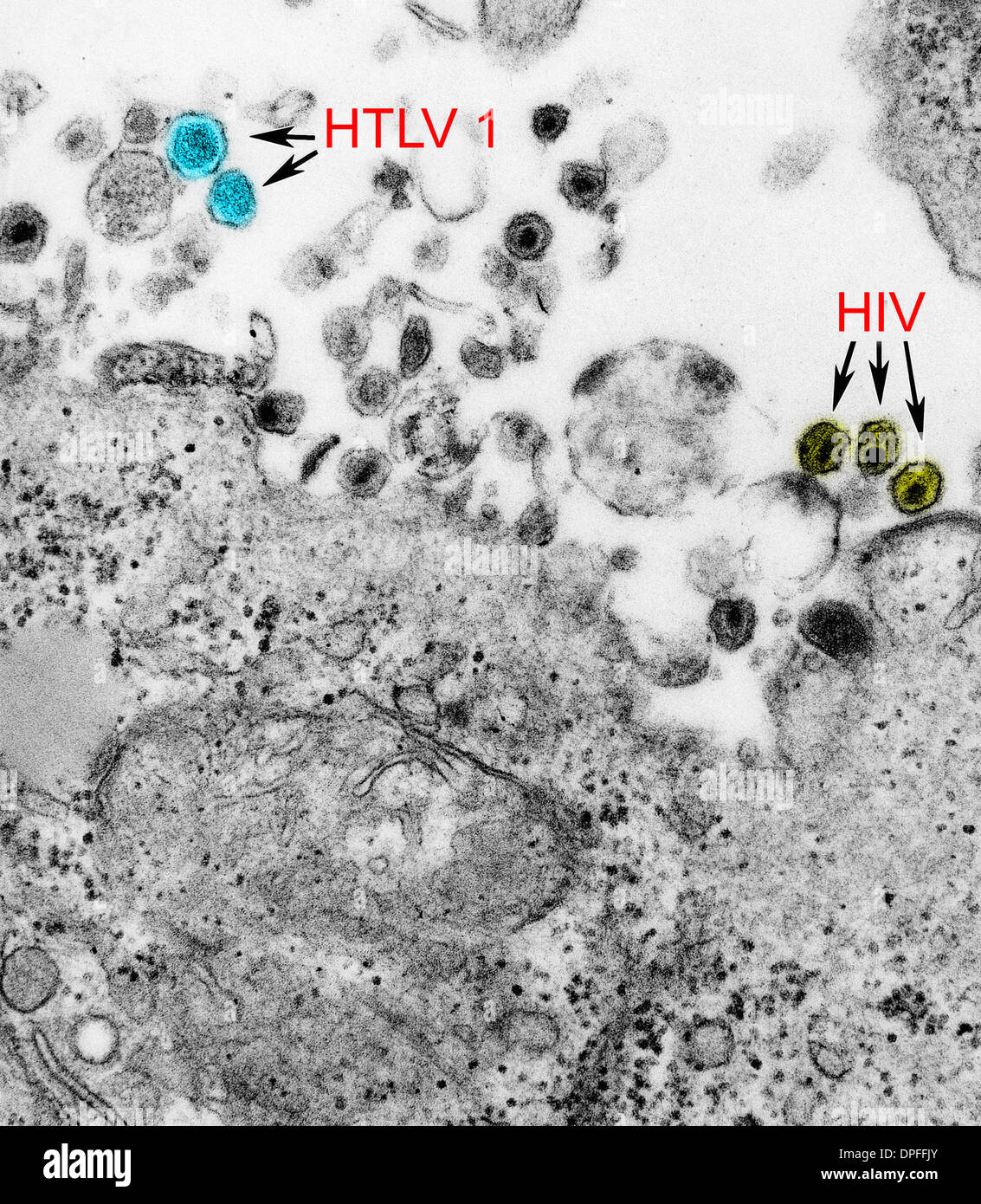 TEM von HTLV-1 und HIV-Viren Stockfoto