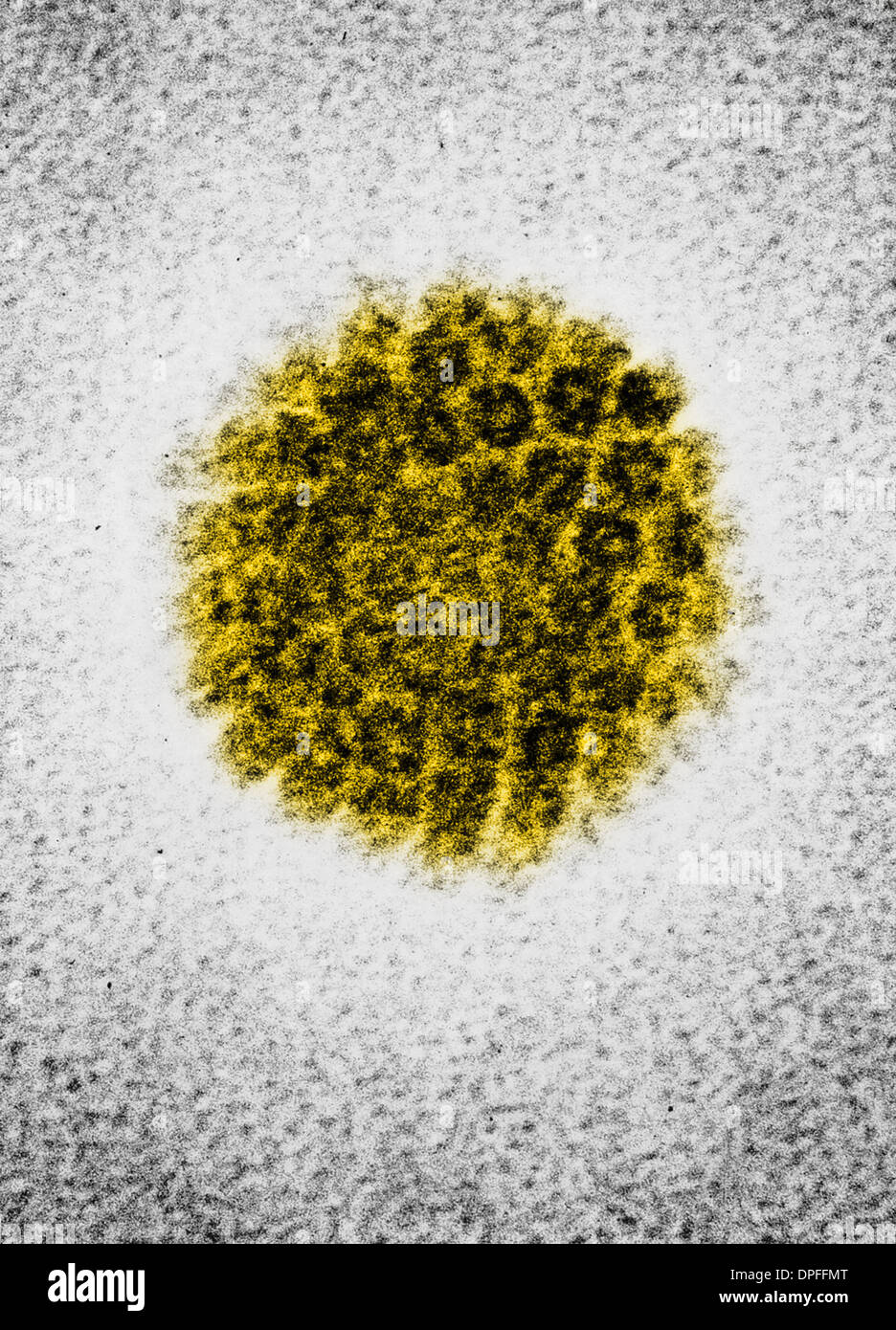 EM von einer humanen Papilloma-Virus (HBV) Stockfoto
