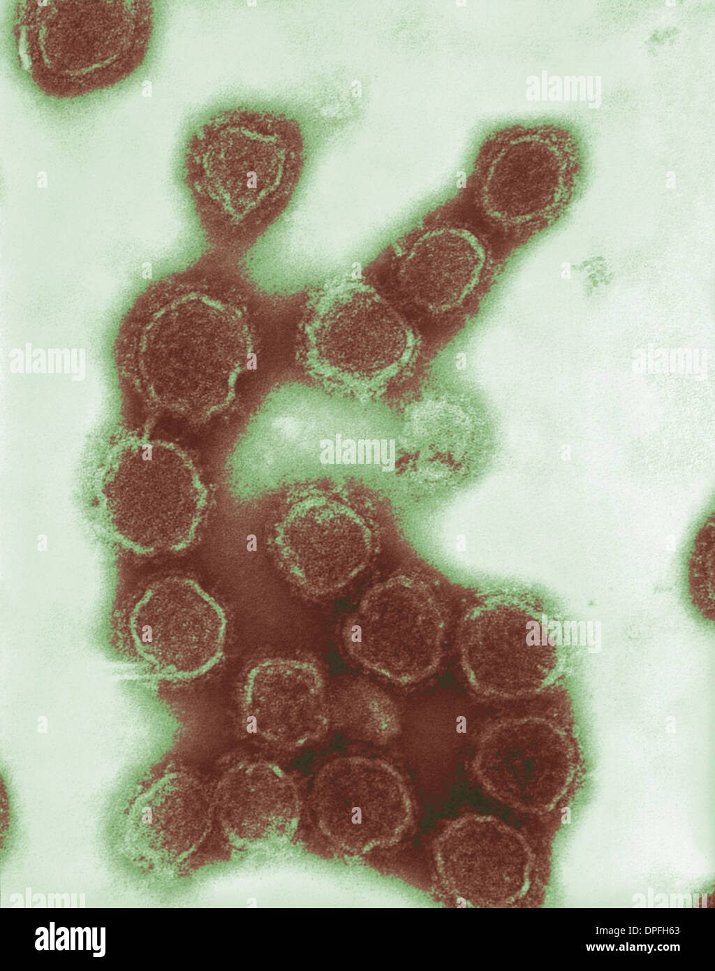TEM of California-Enzephalitis-Virus virion Stockfoto