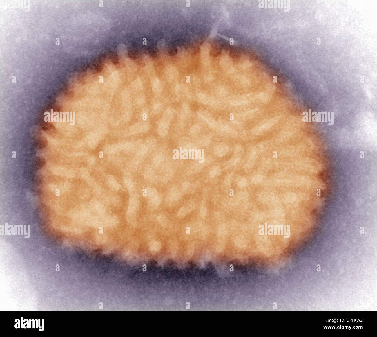 Elektron Schliffbild eines Vaccinia-Virus Stockfoto