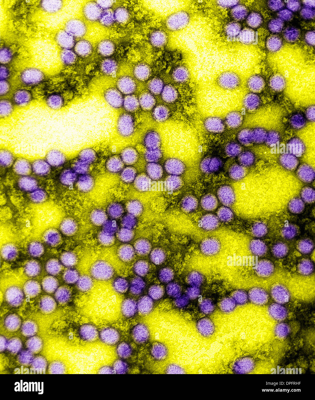 EM-Bild des Gelbfieber-virus Stockfoto