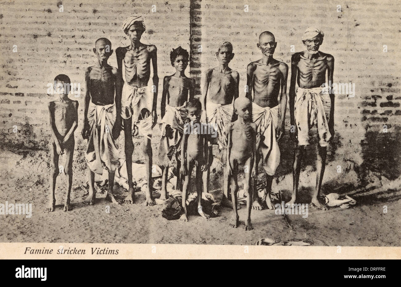 Opfer der Hungersnot - Indien Stockfoto