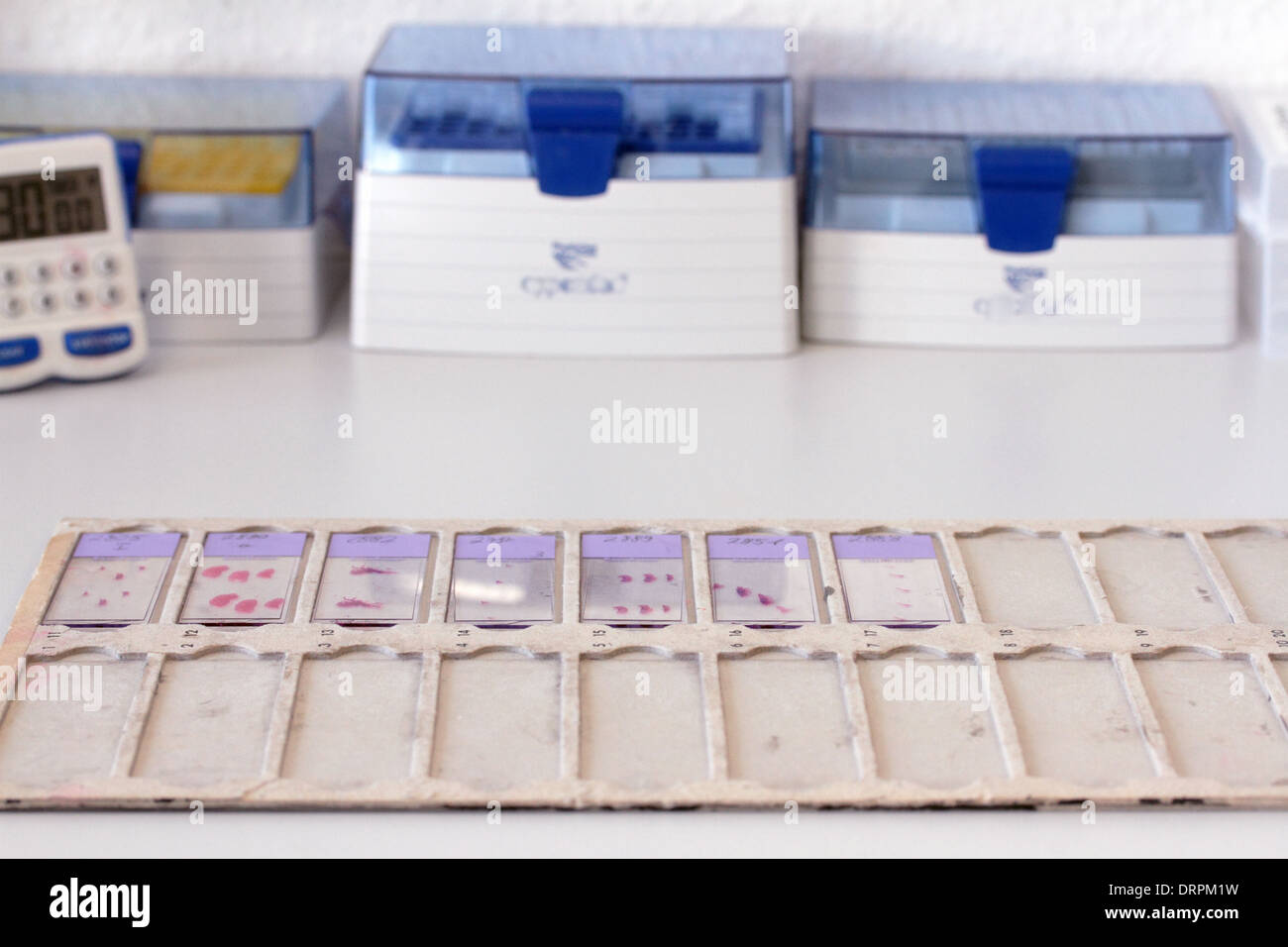 Glas-Objektträger mit histologischen Proben in eine Histologie-labor Stockfoto