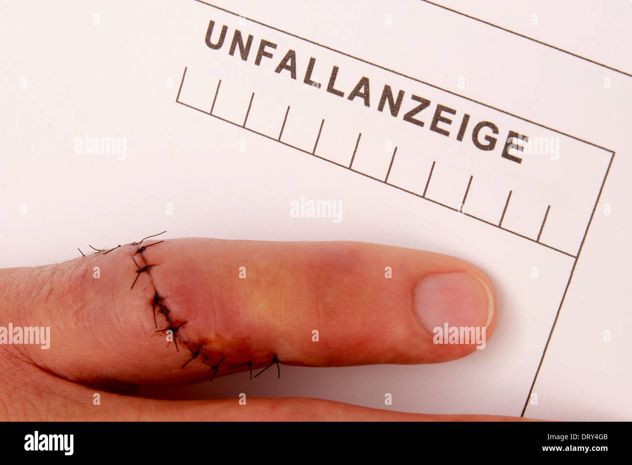 Mann mit vernadelten Finger füllt ein Unfallbericht Stockfoto