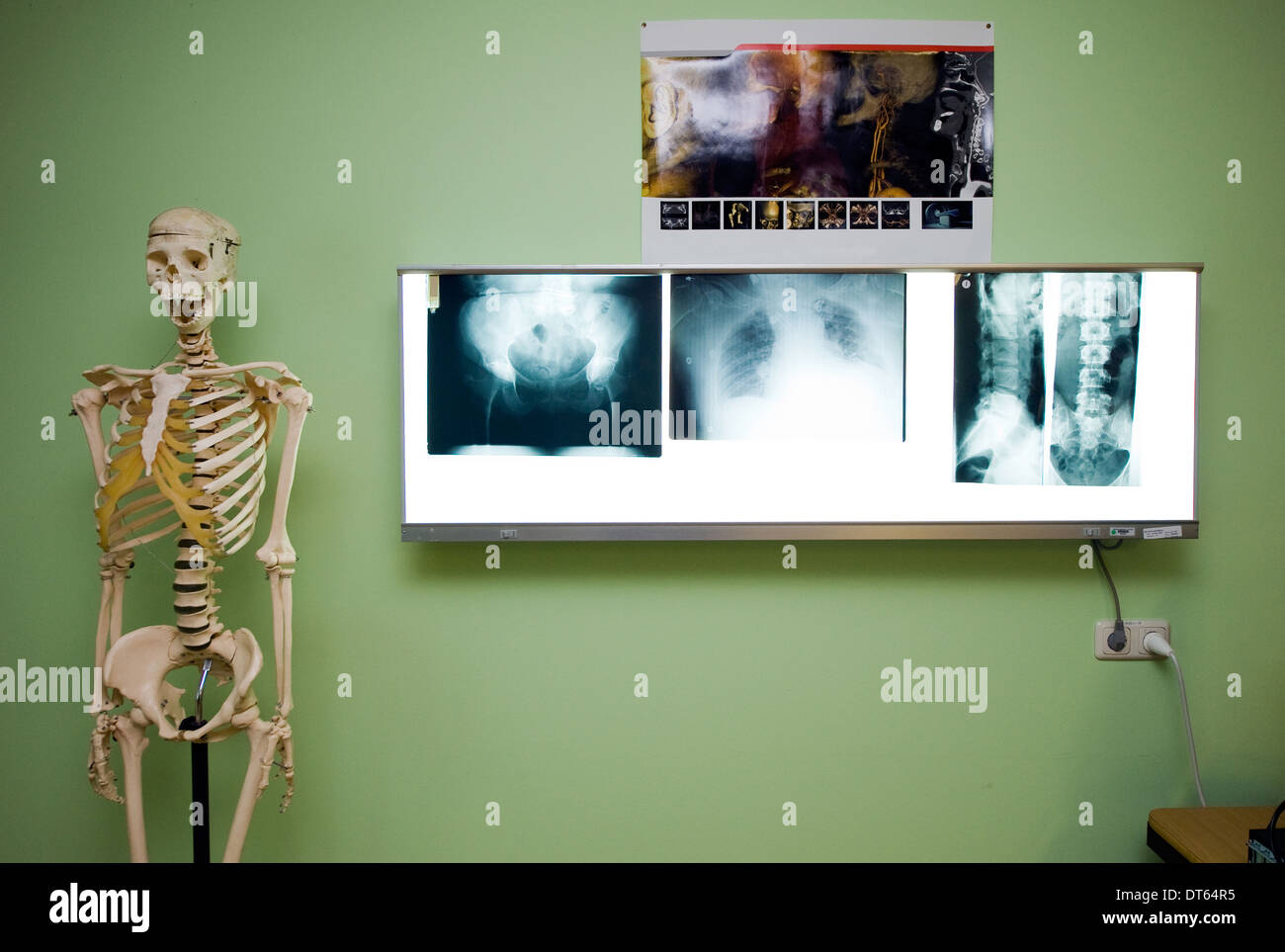 X-ray Foto in einem Krankenhaus Stockfoto