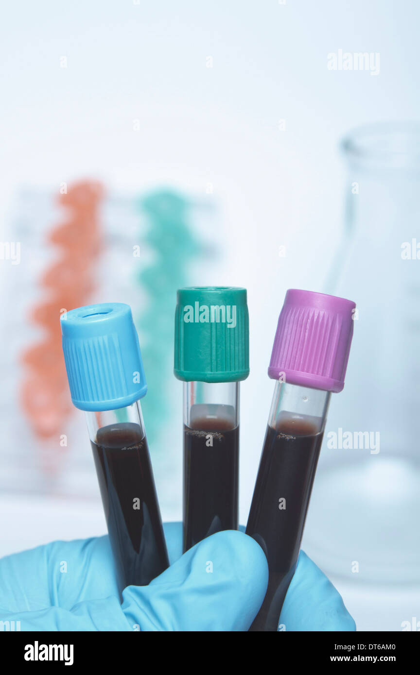 Farbe-kodierte Blut-Röhrchen mit synthetischen Blutproben. Blaues Top - gepufferte Natrium-Citrat. Grüne Spitze - Lithium-heparin Stockfoto