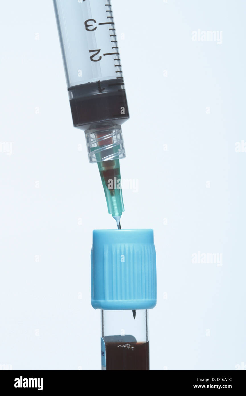 Kunststoff medizinische Einmalspritze in blaues Blut-Röhrchen mit synthetischen Blutprobe eingefügt. Stockfoto