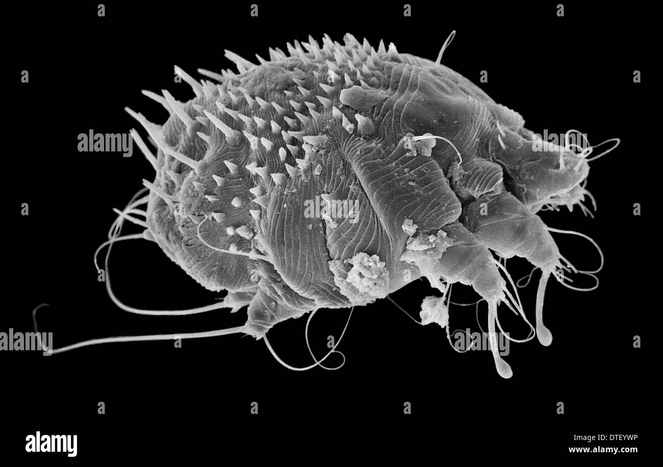 Sarcoptes Scabiei, Krätze Milbe Stockfoto, Bild 66712066 Alamy