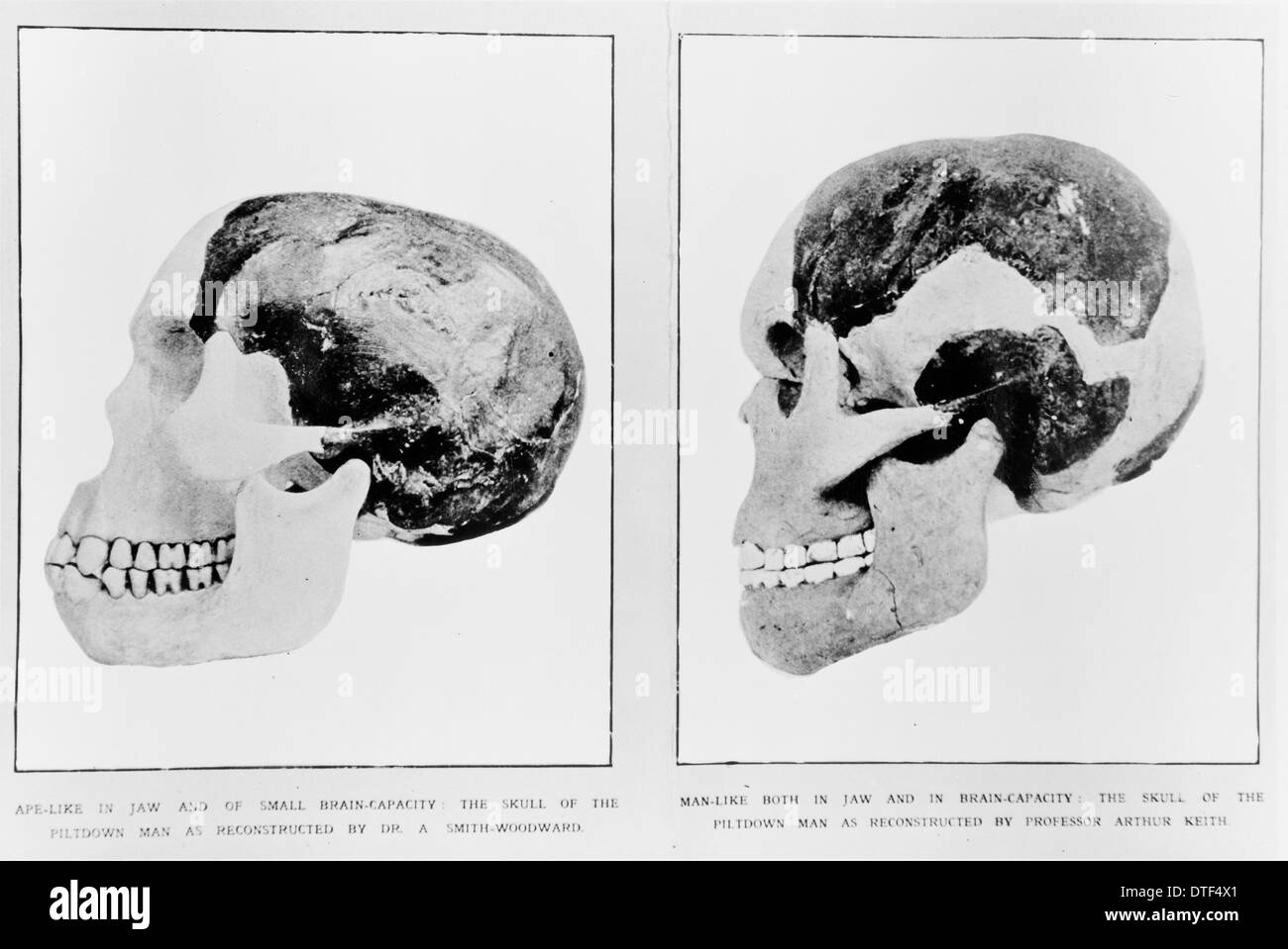 Schädel und Unterkiefer (Piltdown 1 & 2) Stockfoto