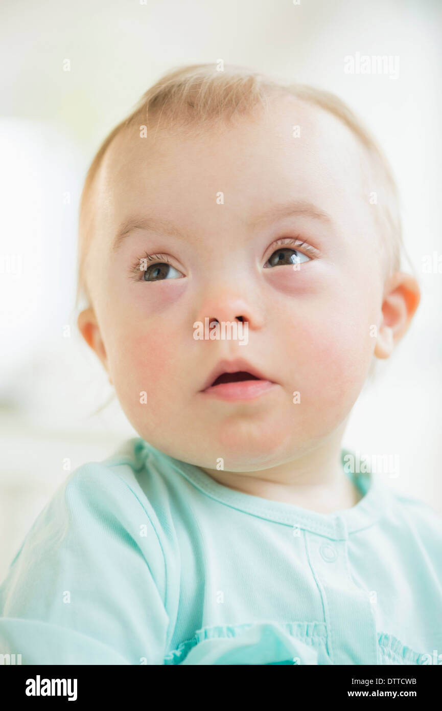 Kaukasische Mädchen mit Down-Syndrom Stockfoto