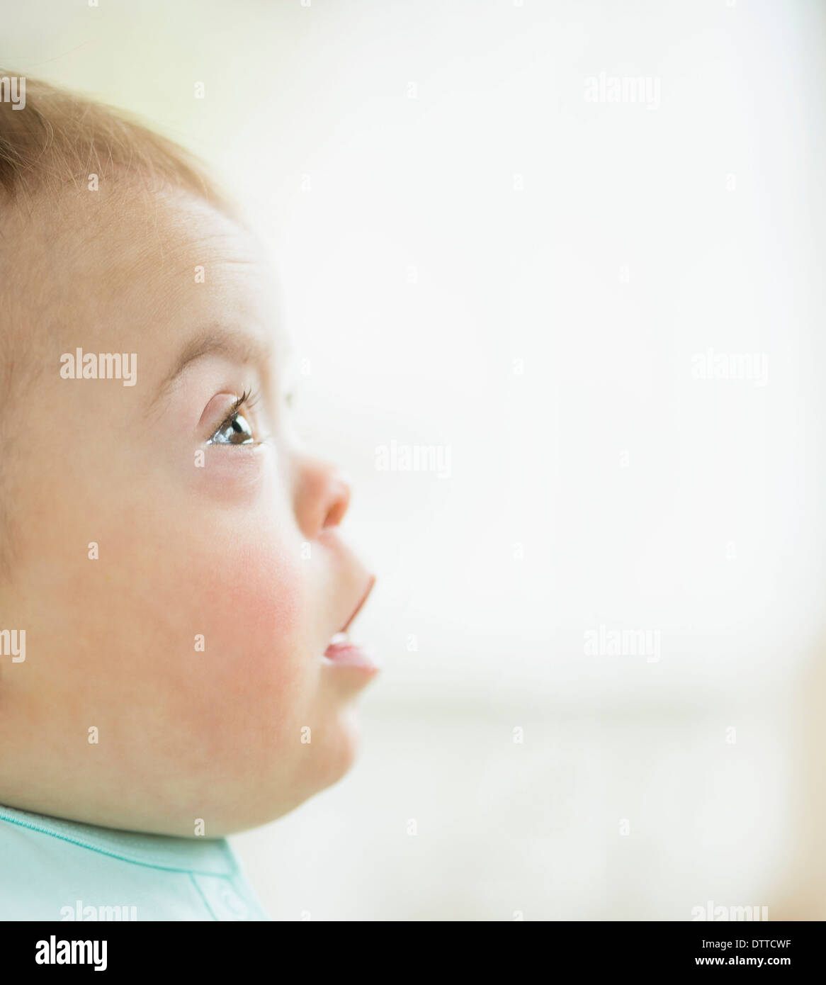 Kaukasische Mädchen mit Down-Syndrom Stockfoto